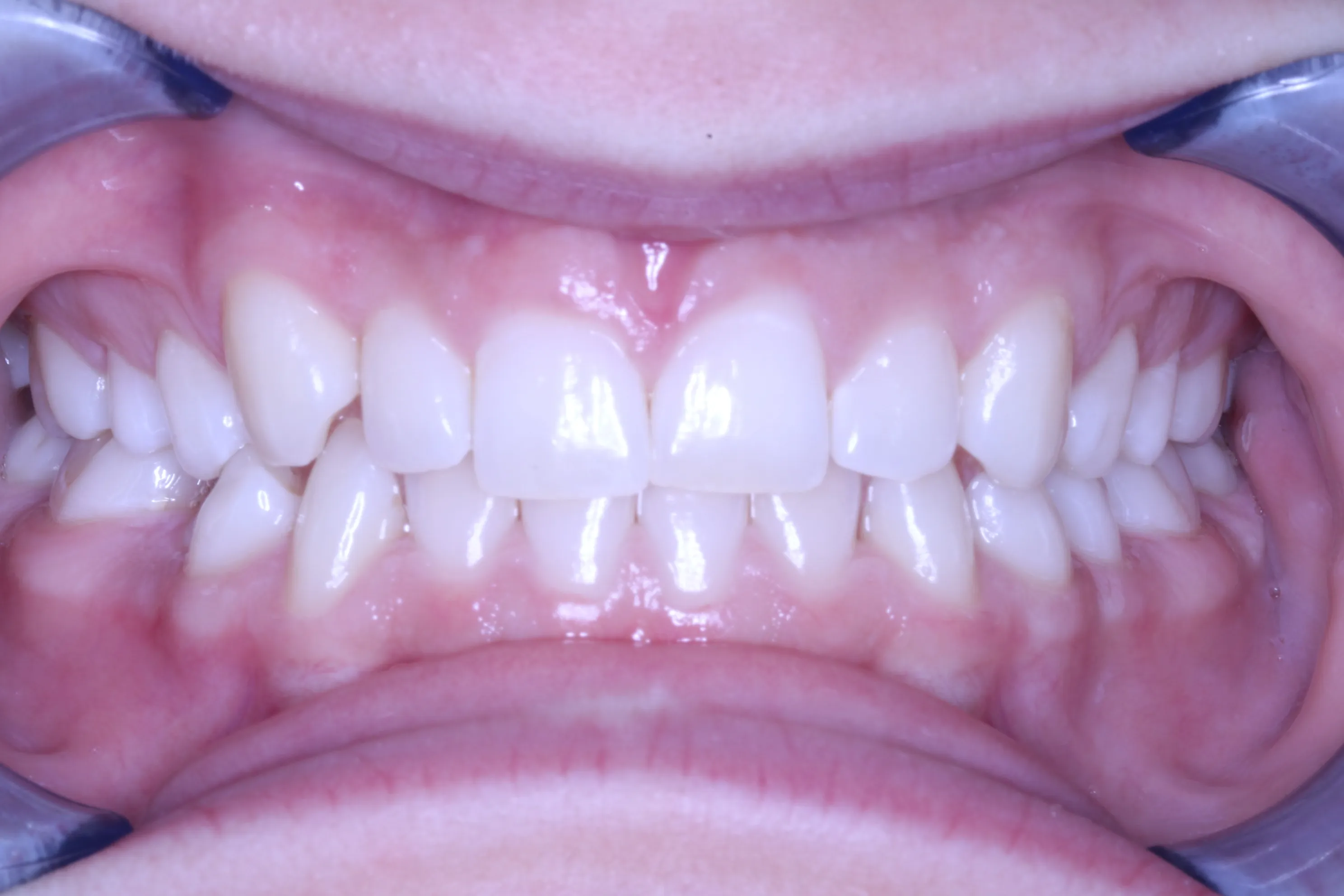 smile-gallery gallery